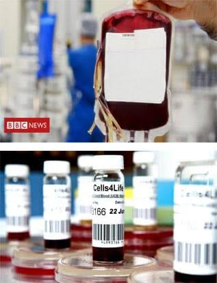 Заблуда и подвеждане на бъдещи родители от Cells4Life при съхранение на стволови клетки – за пореден път!