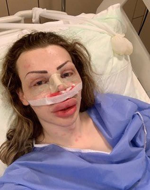 Студент се обяви за безполов, но пръсна 60 000 евро да заприлича на кукла СНИМКИ 18+