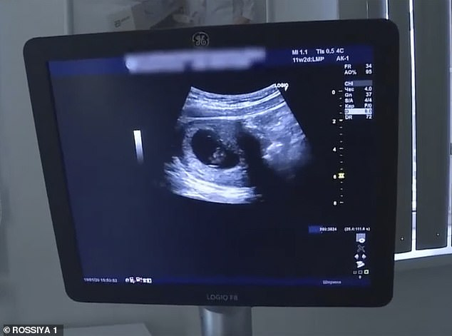 13-годишната Даша забременя, посочи за татко 10-годишния Иван ВИДЕО