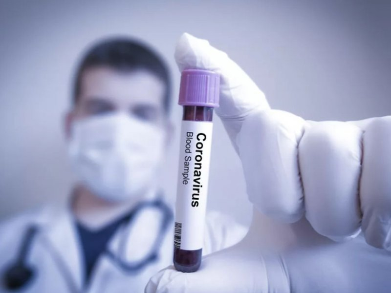 Германски вирусолози посочиха единственото спасение от COVID-19