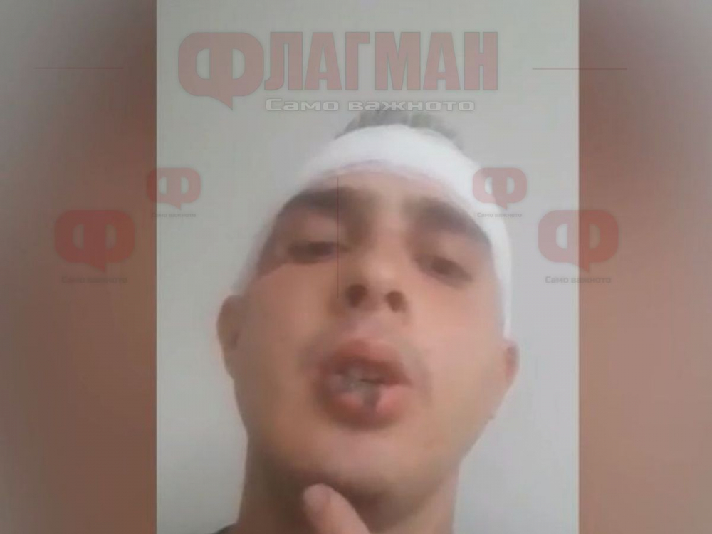Зверски побой над млад музикант с метална тръба в Литаково