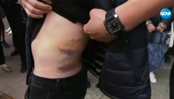 Брутална жестокост: Смазаха от бой младо семейство във Видин, докато разхожда децата си ВИДЕО