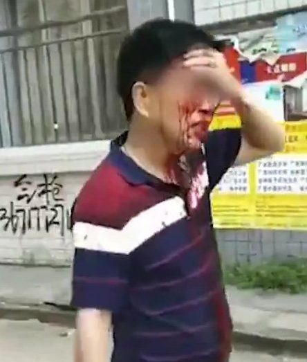 Нападател с нож нахлу в основно училище и започна да коли наред ВИДЕО