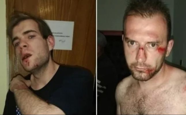 Спецакция на полицията в Секулово, след като тумба от 30 цигани пребиха Боби Ейнджъл