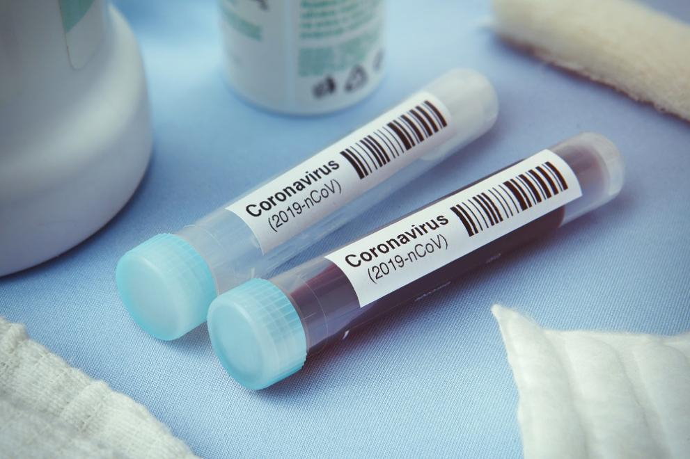 Джихадистка групировка отвори център за лечение на терористи с COVID-19 в Сомалия