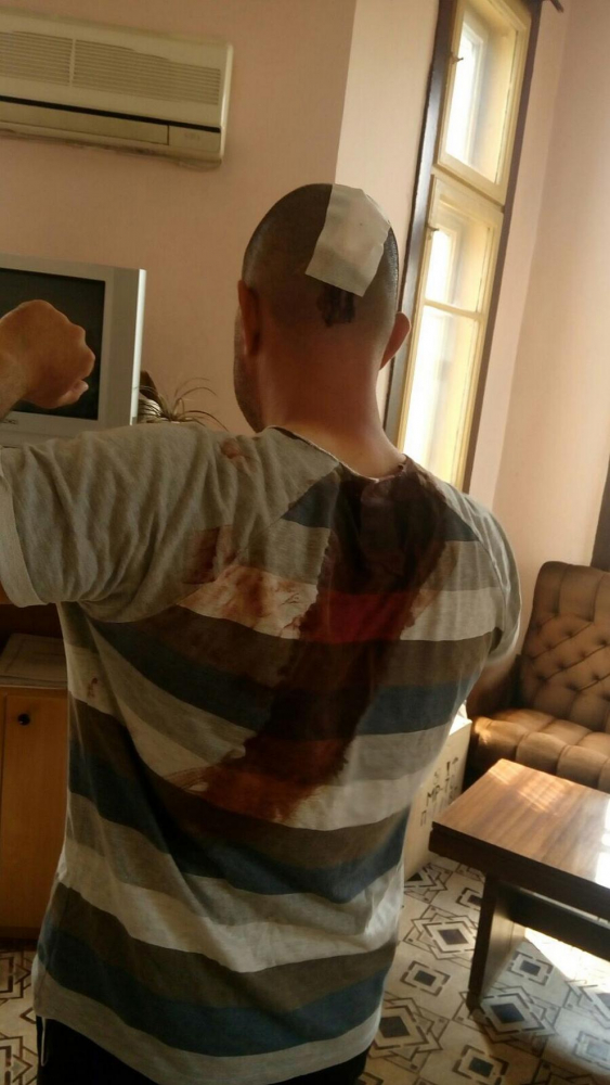 Шокиращи СНИМКИ 18+ на полицаите, ранени от безчинстващите цигани