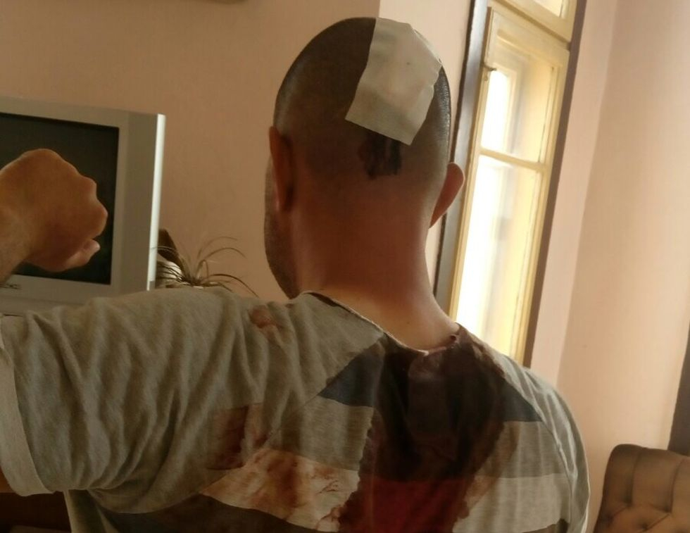 Шокиращи СНИМКИ 18+ на полицаите, ранени от безчинстващите цигани