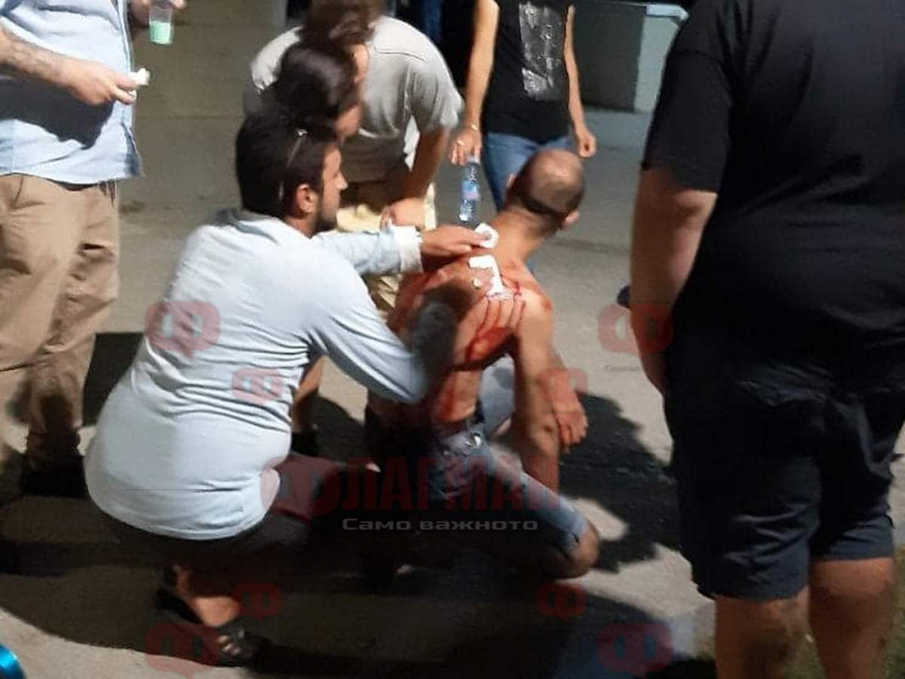 Ужас в Бургас! Наръгаха мъж 4 пъти в гърба пред погледа на десетки ВИДЕО 18+