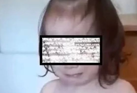 Социалното министерство каза какво ще се случи със зверски битото момиченце в Перник