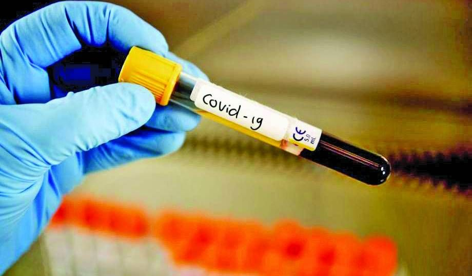 Областният управител на Добрич е с COVID-19