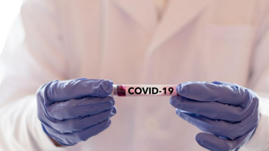 Кошмарна вест от Пловдив: COVID-19 отне живота на млад мъж