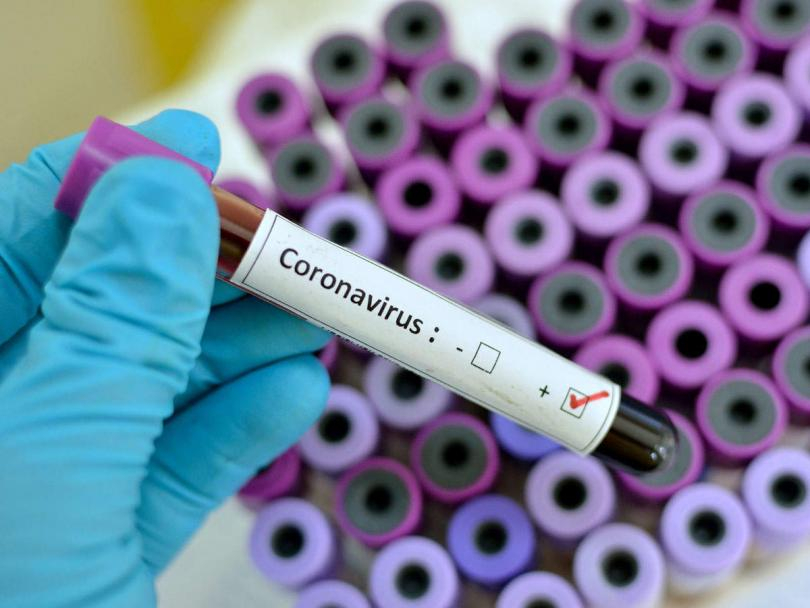 Оказа се фейк: Професорка развенча най-страшния мит за COVID-19