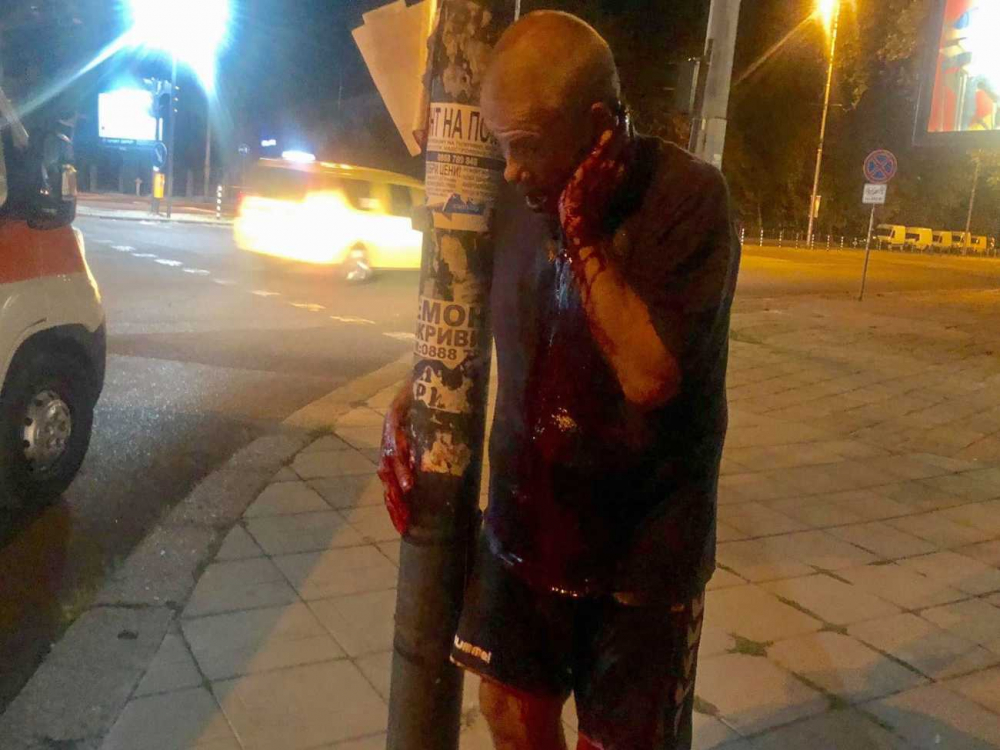 Зловещо и кърваво ВИДЕО 18+ от нощен Бургас