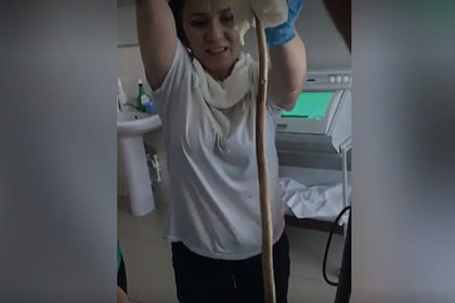 Жена заспа и змия по-дълга от метър влезе в устата й ВИДЕО 