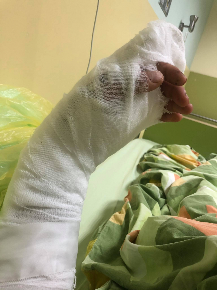 ВМРО алармира за нечовешко зверство: Цигани сякоха с мачете млад мъж в Роман СНИМКИ 18+
