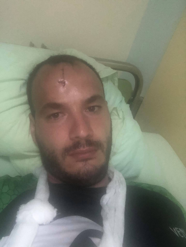 ВМРО алармира за нечовешко зверство: Цигани сякоха с мачете млад мъж в Роман СНИМКИ 18+