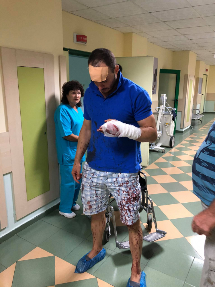 ВМРО алармира за нечовешко зверство: Цигани сякоха с мачете млад мъж в Роман СНИМКИ 18+