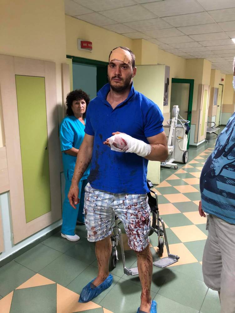 ВМРО алармира за нечовешко зверство: Цигани сякоха с мачете млад мъж в Роман СНИМКИ 18+
