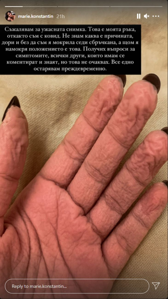 Страшна СНИМКА: Кошмарен нов симптом на К-19 обезобрази щерката на Гала 