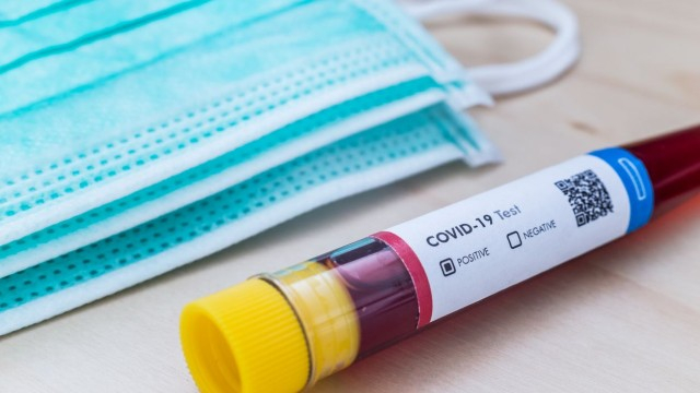 Сводка за COVID-19 у нас:  Тази събота бе най-добрият ден от много време насам!