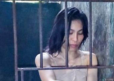 Млада красавица живее в клетка от 5 години заради ужасна болест ВИДЕО 