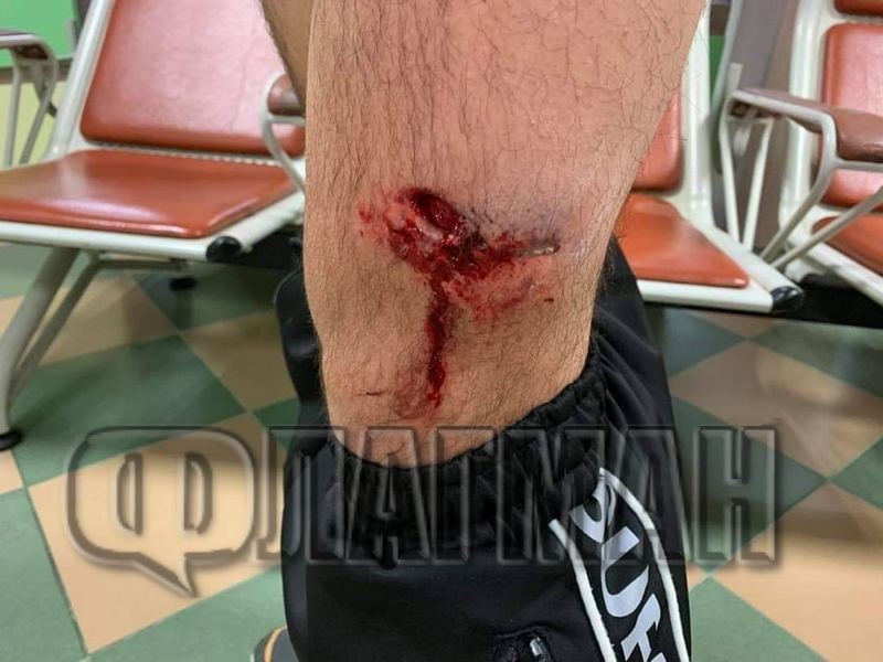 Проговори жертвата на кримигероя Камбаната в Бургас: Помислих, че... СНИМКИ 18+