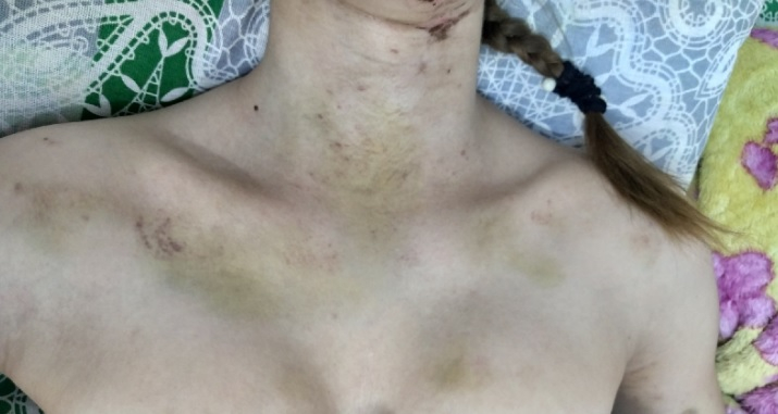 Ужасяващо: Изверг преби почти до смърт приятелката си СНИМКИ 18+