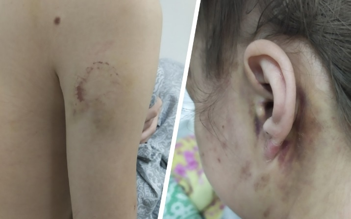 Ужасяващо: Изверг преби почти до смърт приятелката си СНИМКИ 18+