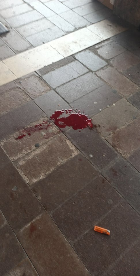 Ужасна гледка в Бургас: Мъж с окървавена глава седи пред Водната палата СНИМКИ