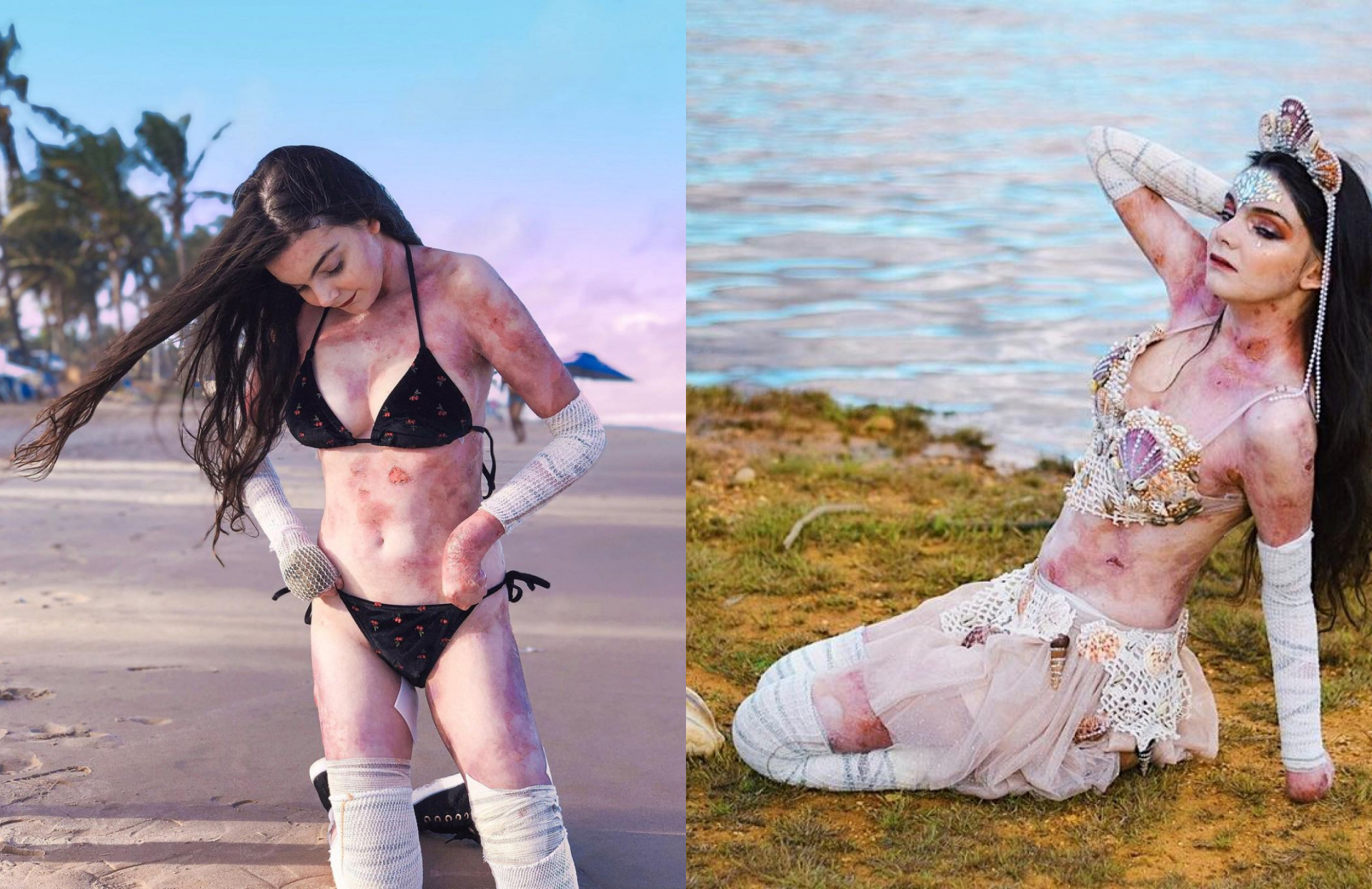 Тялото на моделка е обезобразено, но всички са влюбени в нея СНИМКИ 18+