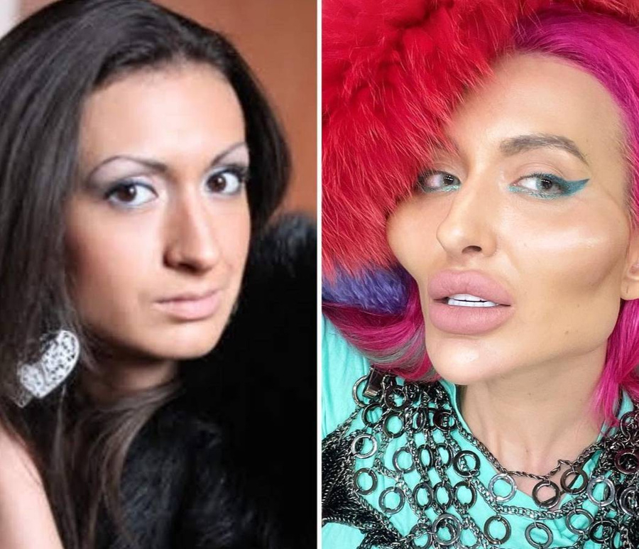32-годишната Анастасия се обезобрази! Плашещи СНИМКИ 18+