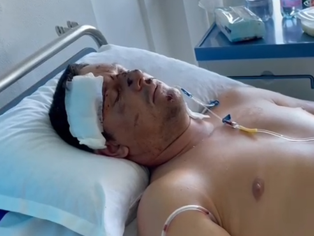 17 г. момче бере душа след трагедията с двете деца и баща им в Айтос, а шофьорът-убиец проговори и... СНИМКА