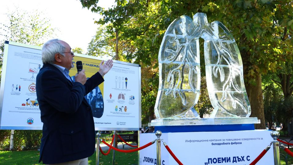 Ледена скулптура показва как фиброзата уврежда дробовете ми СНИМКА