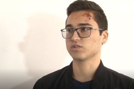 Ученикът, бит от полицай: Свали ми очилата с шамар ВИДЕО