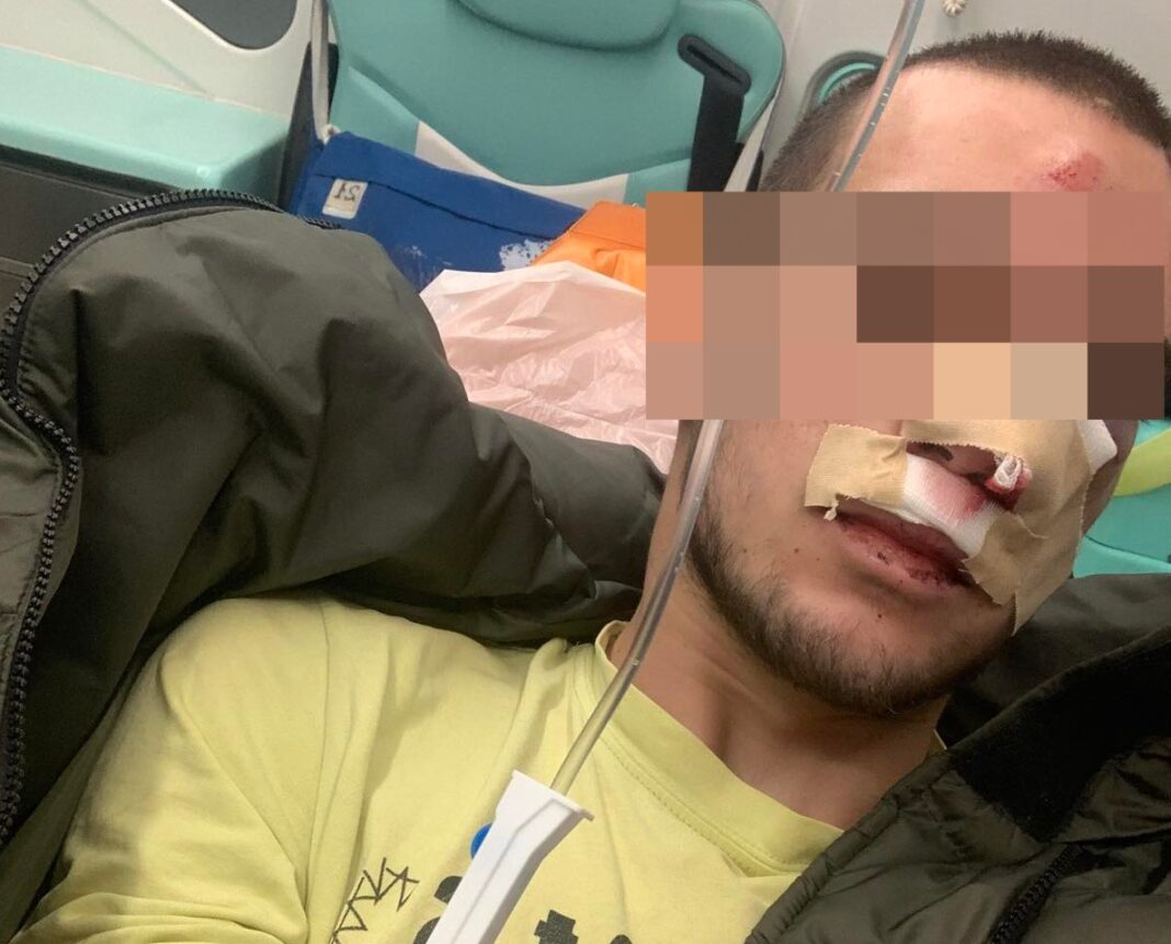 19-г. стана жертва на брутален побой пред дома си в Казанлък ВИДЕО 18+