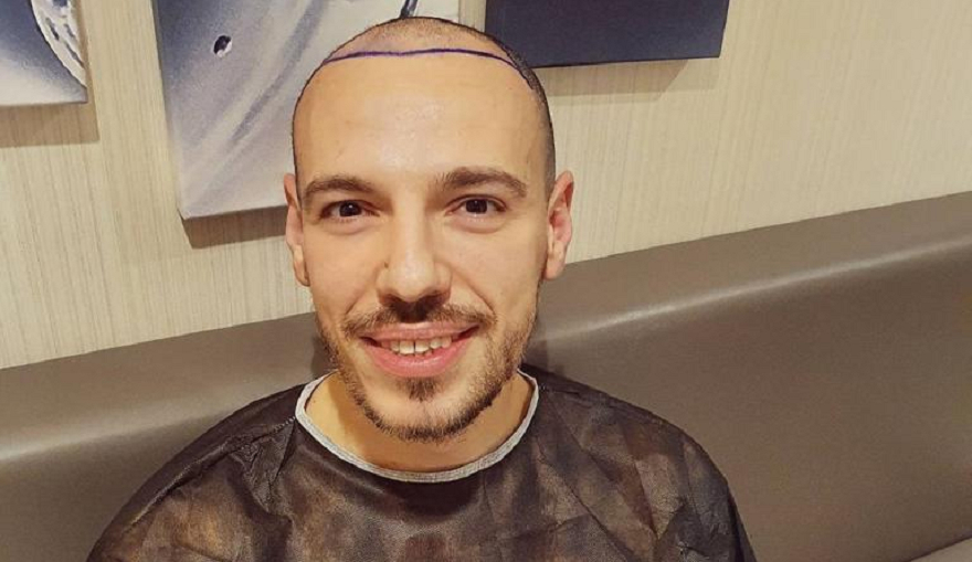 Ето кои популярни българи присадиха нов перчем СНИМКИ