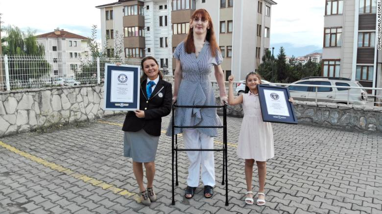 В Турция живее най-високата жена на планетата СНИМКИ