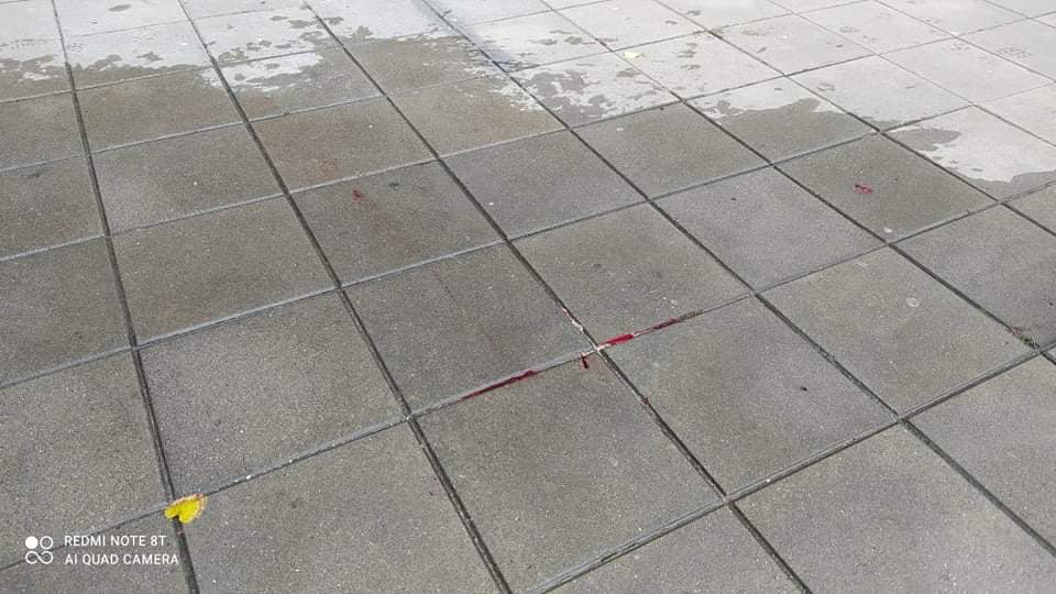 Ужасяващи подробности за трагедията с болна възрастна жена в Пловдив СНИМКИ 18+
