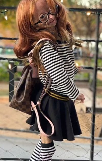 Странна болест уби 15-г. YouTube звезда СНИМКИ 18+