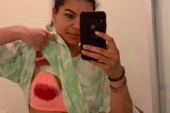 Момиче показа ужасните последици от интимен пиърсинг ВИДЕО 18+