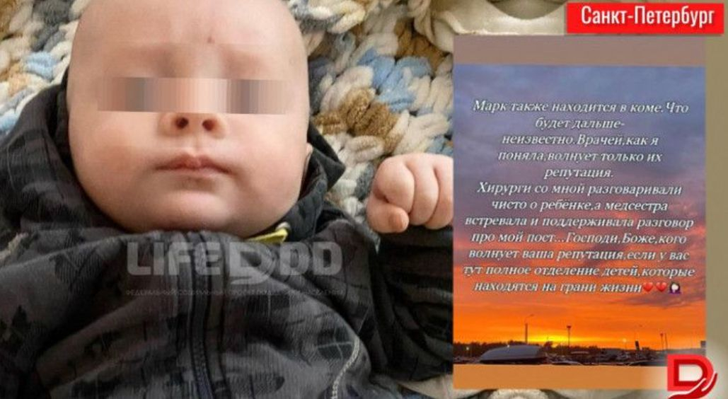 Бебе на 2 месеца е в медикаментозна кома след инсулт, причинен от Омикрон
