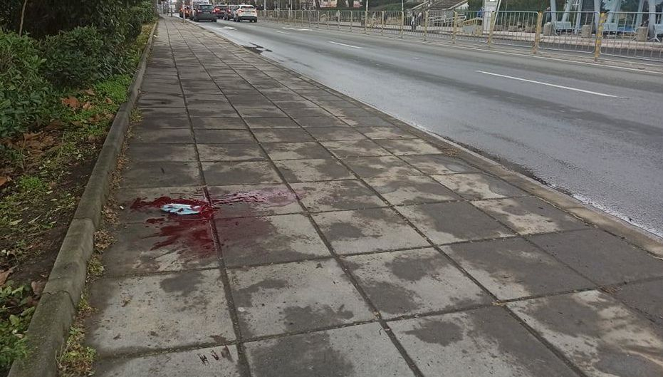 Кървав инцидент в Бургас, на метри от училище СНИМКИ