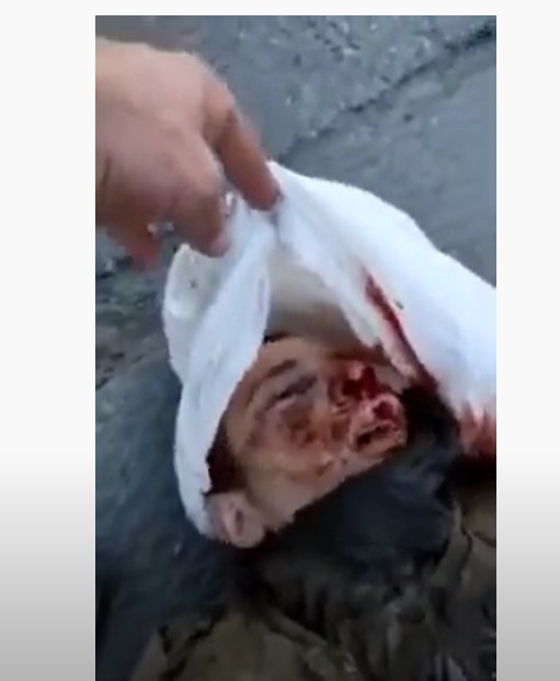 Брутално ВИДЕО 18+ с гаври, изтезания и убийства на пленени руски войници в Украйна потресе света