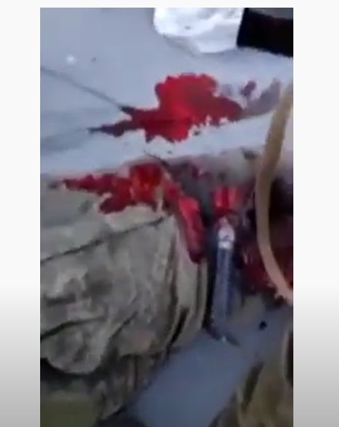 Брутално ВИДЕО 18+ с гаври, изтезания и убийства на пленени руски войници в Украйна потресе света