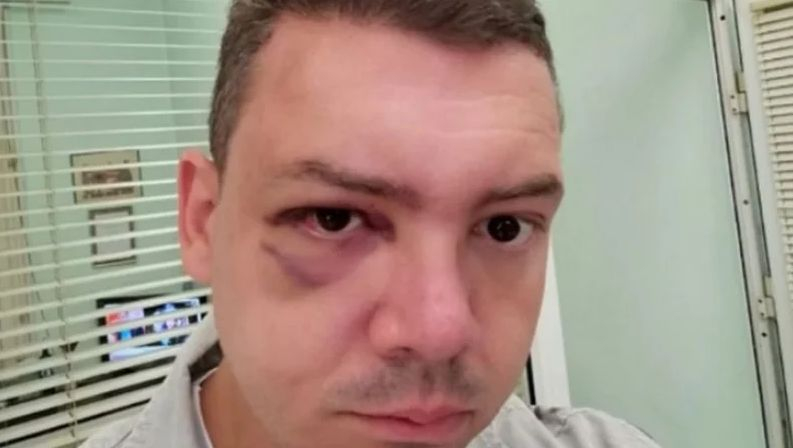 Разпространиха СНИМКА на човека пребил шефа на КТ "Подкрепа" в Либхер