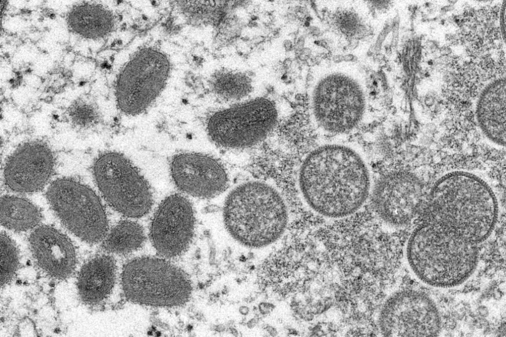 Спешни мерки: САЩ започват ваксинация срещу маймунска шарка 