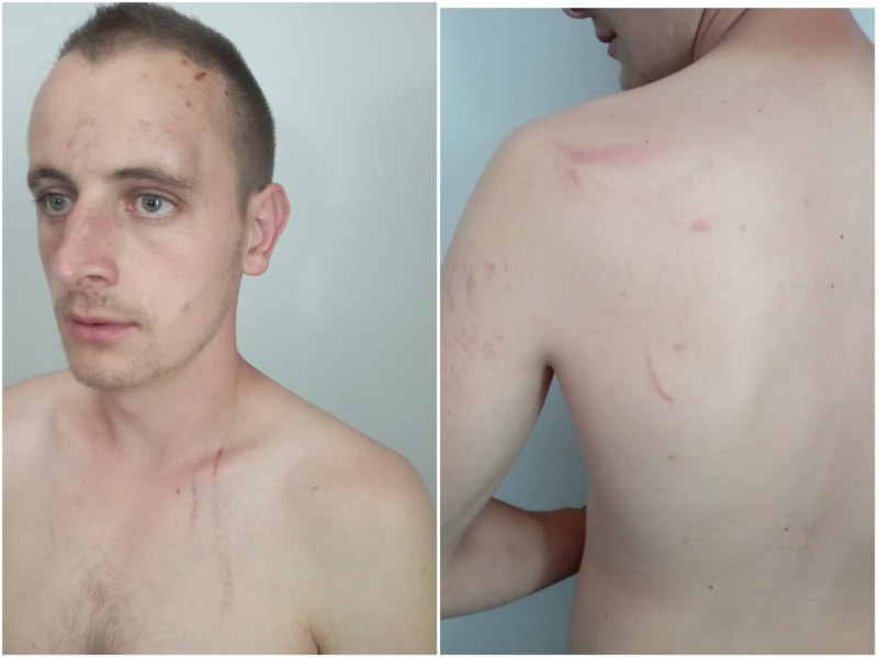 Бракониери пребиха жестоко горски край Кричим СНИМКИ