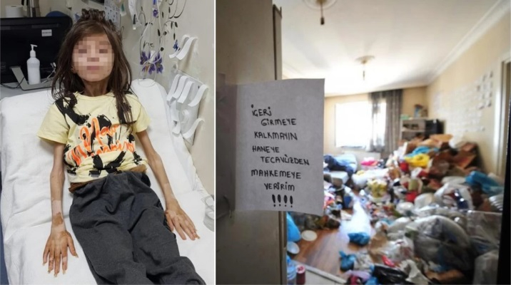 Ужас: Намериха 9-годишно момче, държано под ключ цяла година в невиждана мизерия и глад СНИМКИ