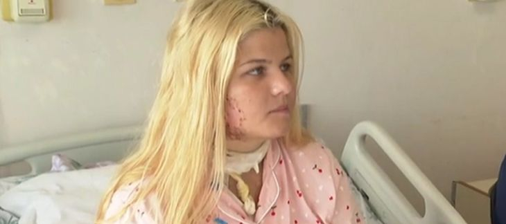 Проговори 18 г. Теодора, ударена от мълния, ето какво се случва с нея ВИДЕО
