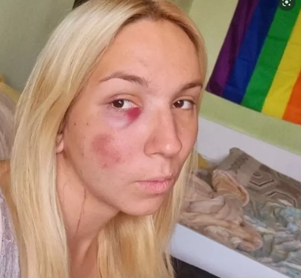 Емили Тротинетката е направила два опита за самоубийство в неделя заради...